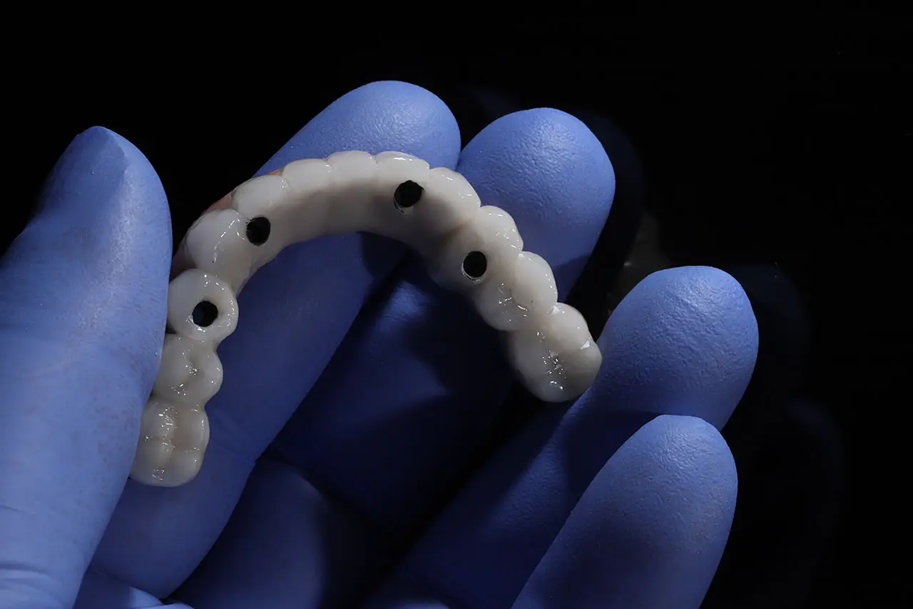 All-On-4 Dental Implants In Largo: A Patient Guide To Full-Arch Smile Restoration